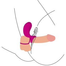   Xocoon Couples Stimulator vibrációs pénisz és heregyűrű, távirányítóval