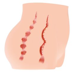 Kokos Cherry maszturbátor